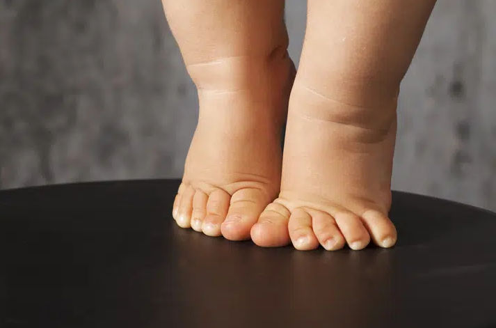 Kinderfysiotherapie s Gravenzande Naaldwijk afwijkend looppatroon tenen lopen